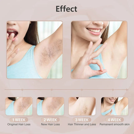 Laser Epilator IPL Hair Removal For Women Body Bikini Facial 990000 Flashes Permanant Painless IPL Hair Remover Laser Epilator